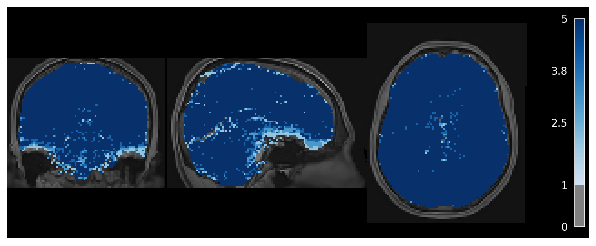 ../_images/fig_adaptive_mask.png