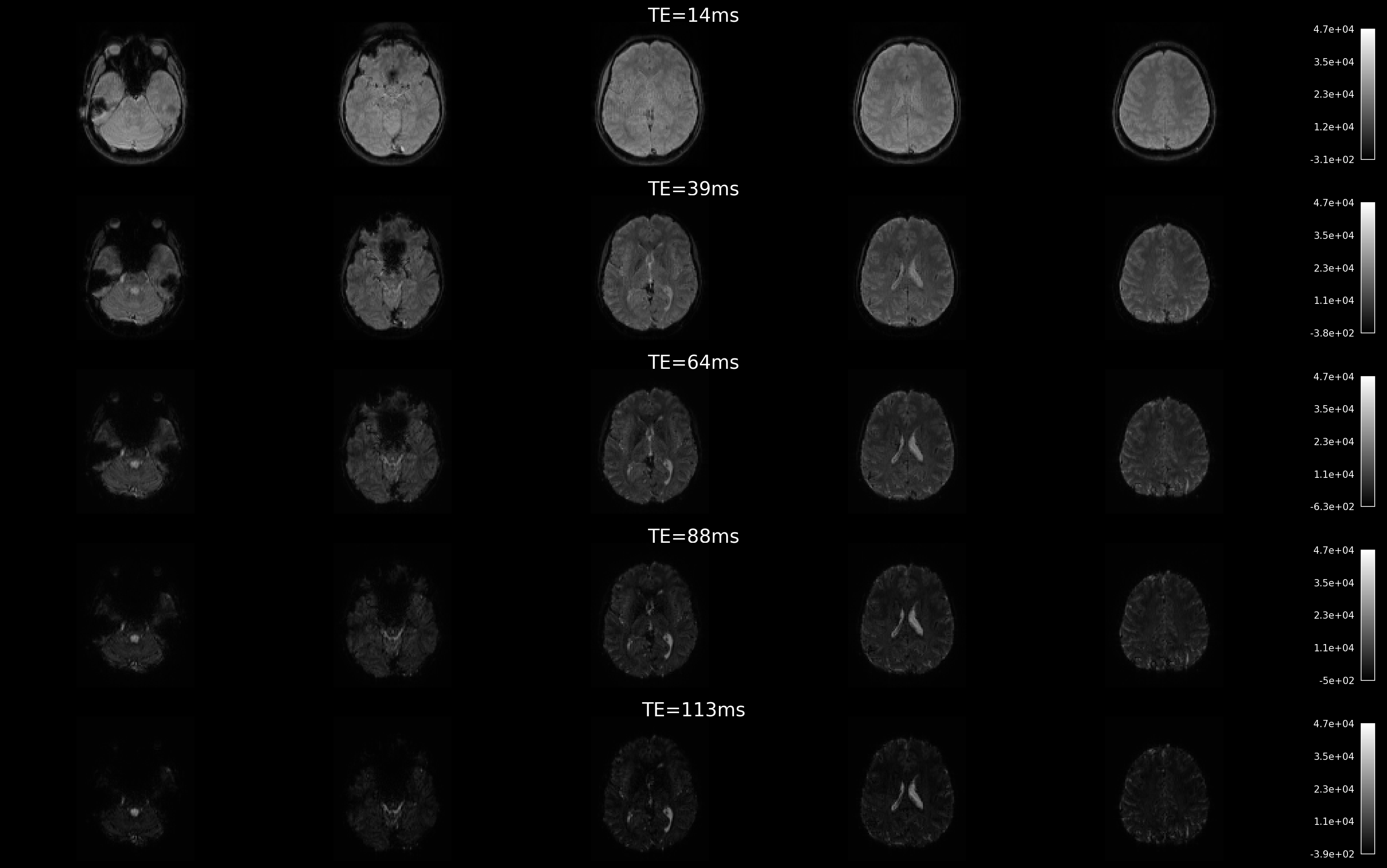 ../_images/fig_brain_decay.png