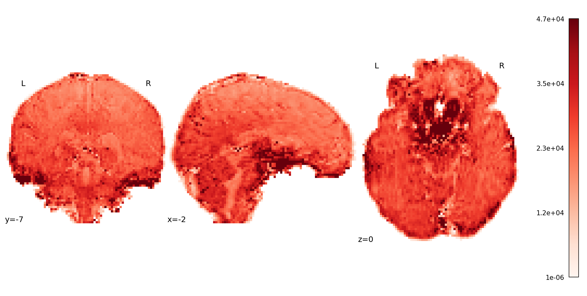 ../_images/figure_mean_volumewise_s0.png