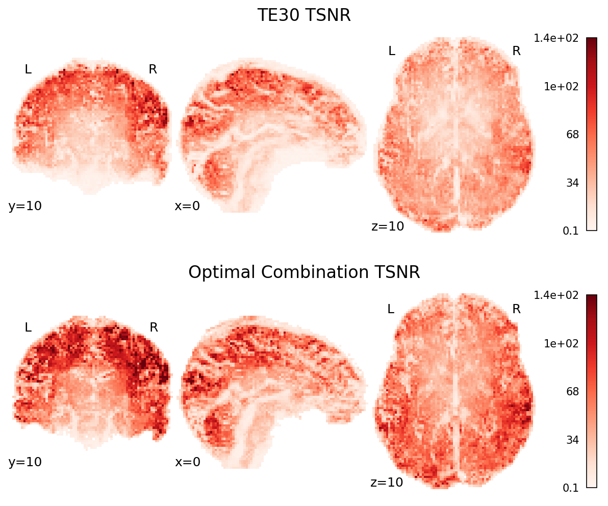 ../_images/figure_t2smap_t2snr.png