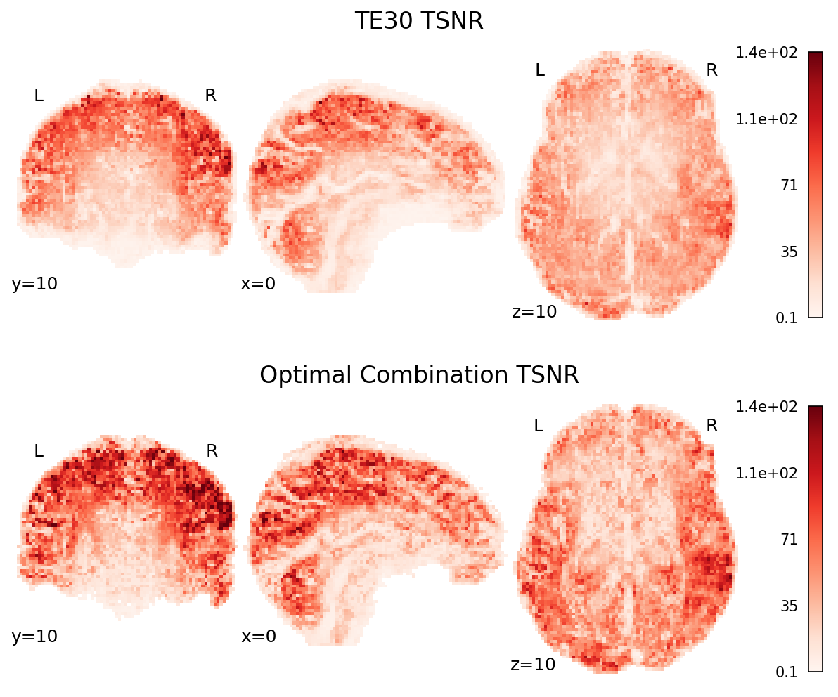 ../_images/figure_t2snr_te30_and_optcom.png